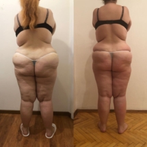 49AB9761-5606-46FB-A638-1CFD702897B0-1024x1024