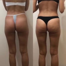 C8859493-D6B1-4CD9-A7B9-0EA17D37FBE9-576x1024