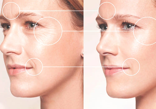 Хіромасаж обличчя ціна